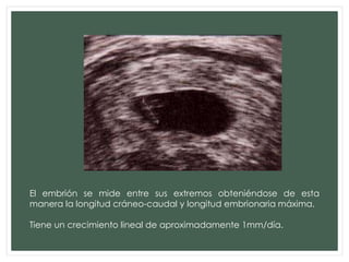 El embrión se mide entre sus extremos obteniéndose de esta
manera la longitud cráneo-caudal y longitud embrionaria máxima.
Tiene un crecimiento lineal de aproximadamente 1mm/día.
 