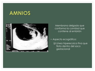 Membrana delgada que
conforma la cavidad que
contiene al embrión
• Aspecto ecográfico:
 Línea hiperecoica fina que
flota dentro del saco
gestacional
 