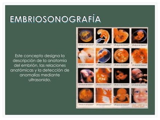 Este concepto designa la
descripción de la anatomía
del embrión, las relaciones
anatómicas y la detección de
anomalías mediante
ultrasonido.
 