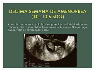 A las diez semanas la cola ha desaparecido, se individualizan las
manos y pies y el embrión tiene aspecto humano. El estómago
puede verse en el 70% de los casos.
 