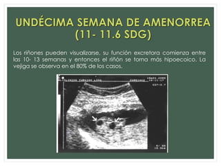 Los riñones pueden visualizarse, su función excretora comienza entre
las 10- 13 semanas y entonces el riñón se torna más hipoecoico. La
vejiga se observa en el 80% de los casos.
 