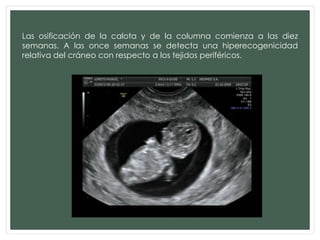Las osificación de la calota y de la columna comienza a las diez
semanas. A las once semanas se detecta una hiperecogenicidad
relativa del cráneo con respecto a los tejidos periféricos.
 