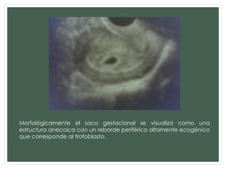 Morfológicamente el saco gestacional se visualiza como una
estructura anecoica con un reborde periférico altamente ecogénico
que corresponde al trofoblasto.
 