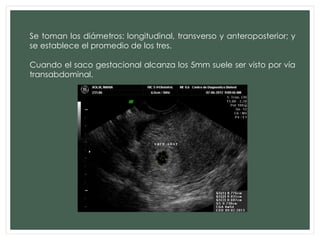 Se toman los diámetros: longitudinal, transverso y anteroposterior; y
se establece el promedio de los tres.
Cuando el saco gestacional alcanza los 5mm suele ser visto por vía
transabdominal.
 