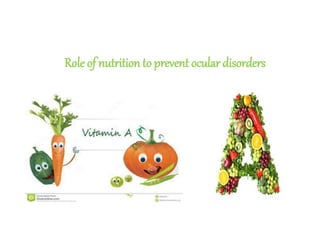 Role of nutrition to prevent ocular disorders
 