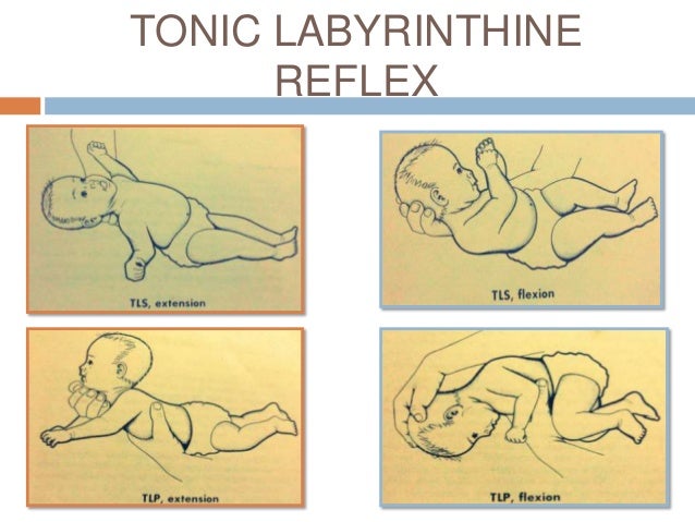 Primitive And Tonic Reflexes