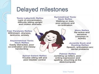 Primitive reflexes | PPTX