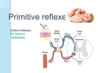 Primitive reflexes
(Infant reflexes)
BY SHALU
THARIWAL
 