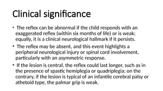 PRIMITIVE REFLEX GROUP 4_0201355891.pptx