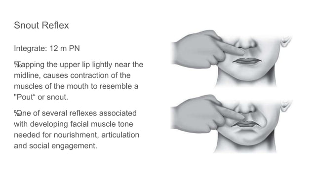 Primitive reflexes and therir pathway . pptxtx | PPTX