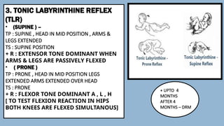 Tlr Reflex Exercise Primitive reflex ppt for physiotherapist | PPTX