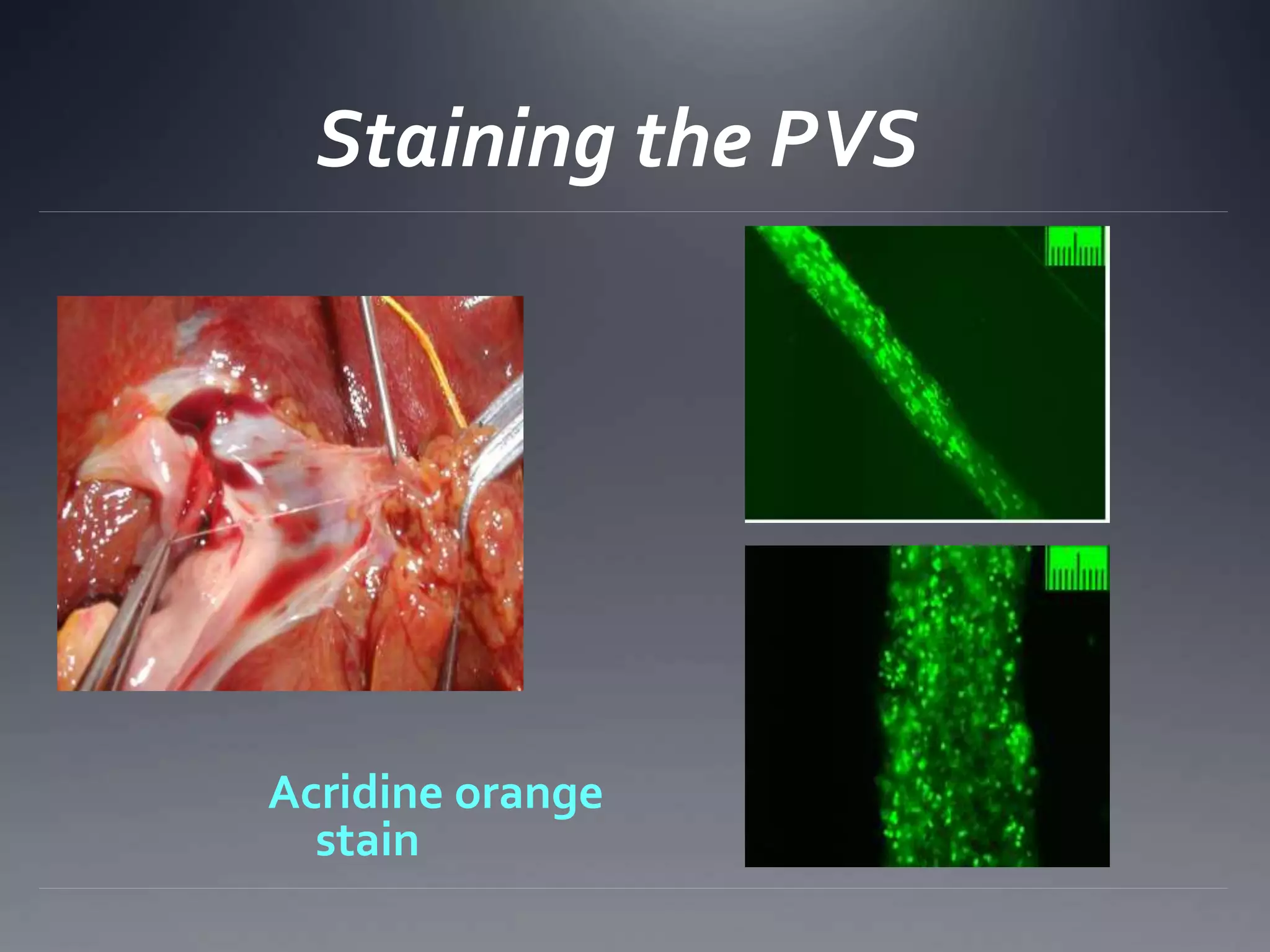 Staining the PVS
Acridine orange
stain
 