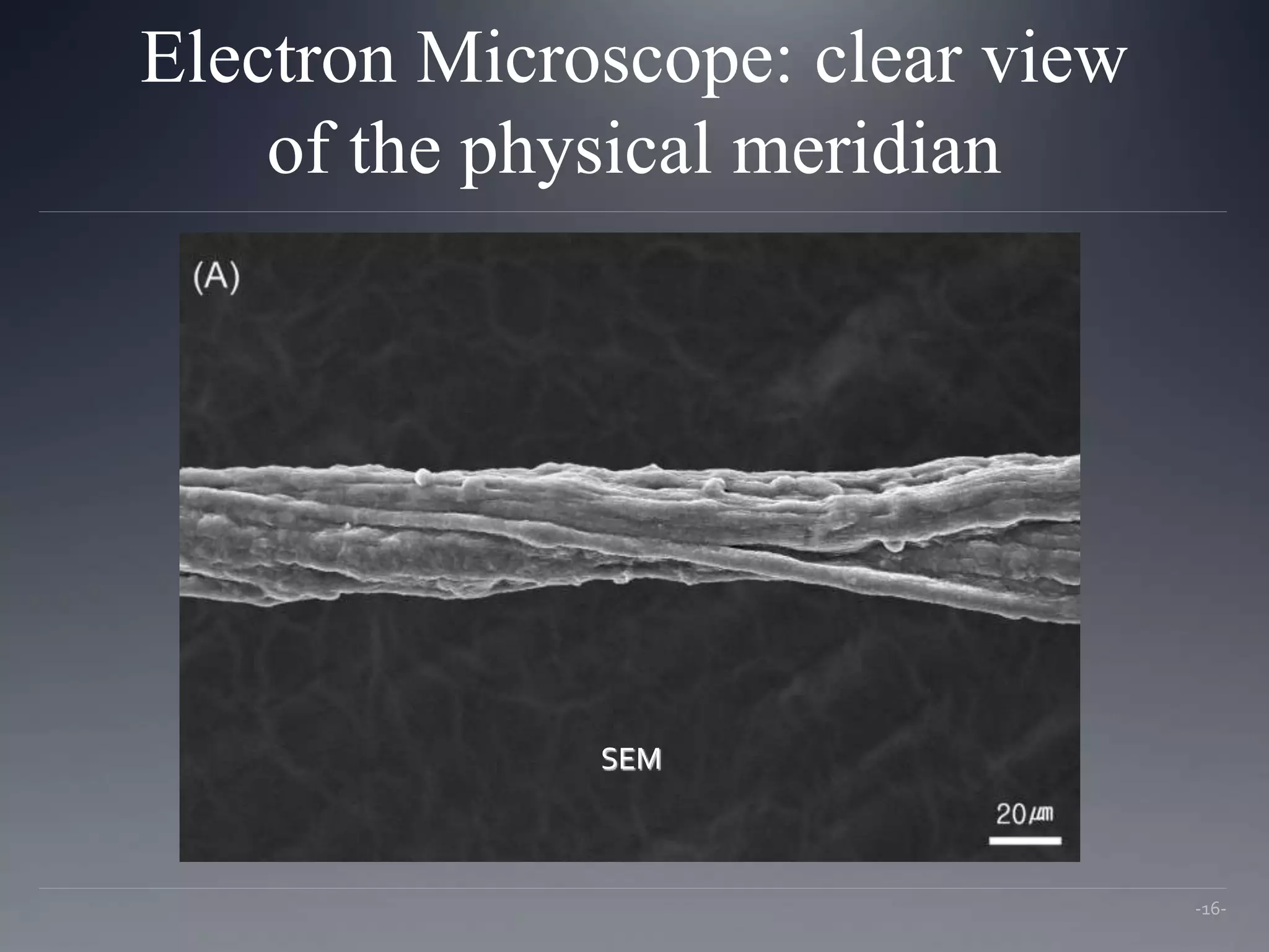 Electron Microscope: clear view
of the physical meridian
-16-
SEM
 