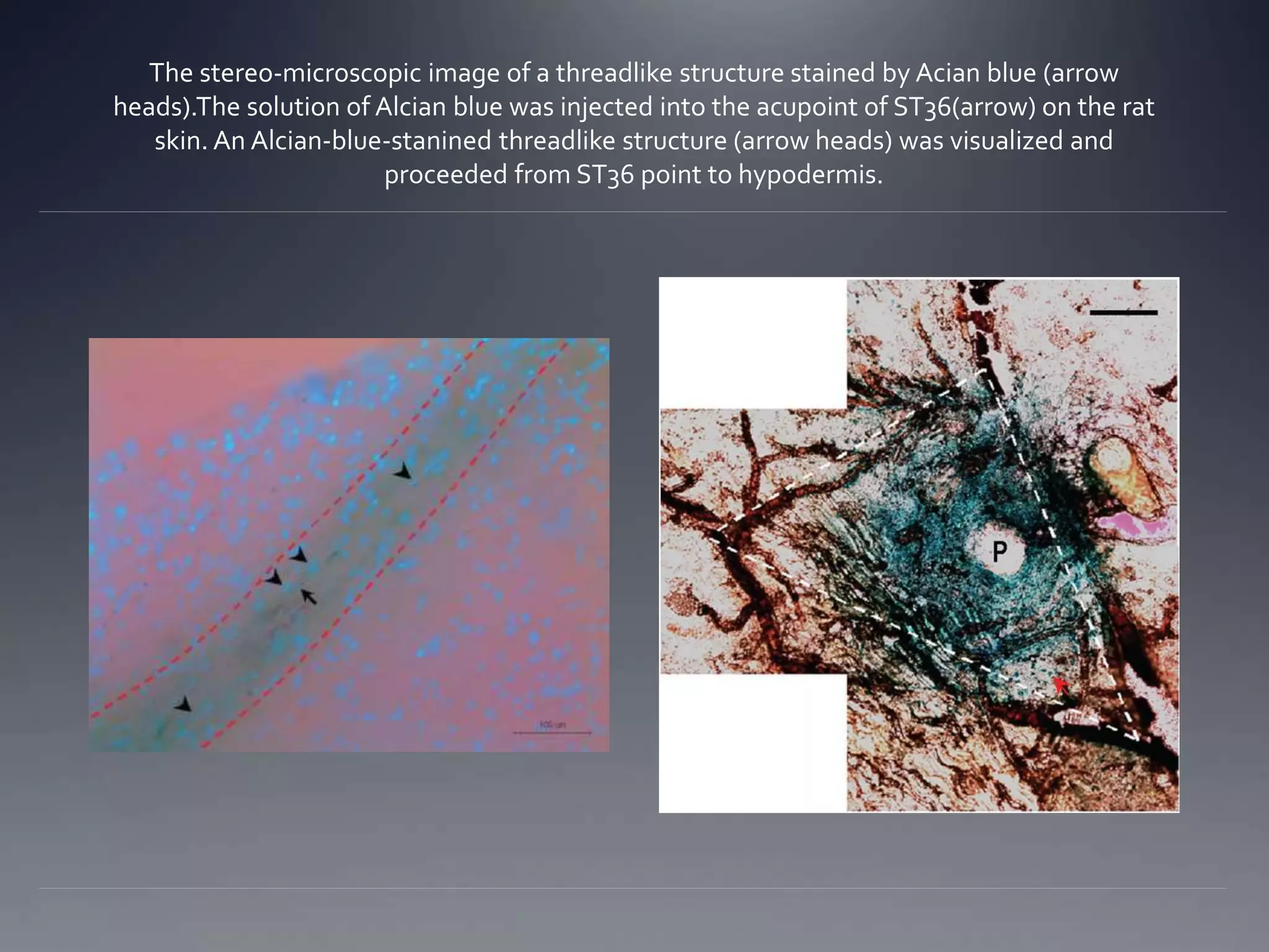 The stereo-microscopic image of a threadlike structure stained by Acian blue (arrow
heads).The solution of Alcian blue was injected into the acupoint of ST36(arrow) on the rat
skin. An Alcian-blue-stanined threadlike structure (arrow heads) was visualized and
proceeded from ST36 point to hypodermis.
 