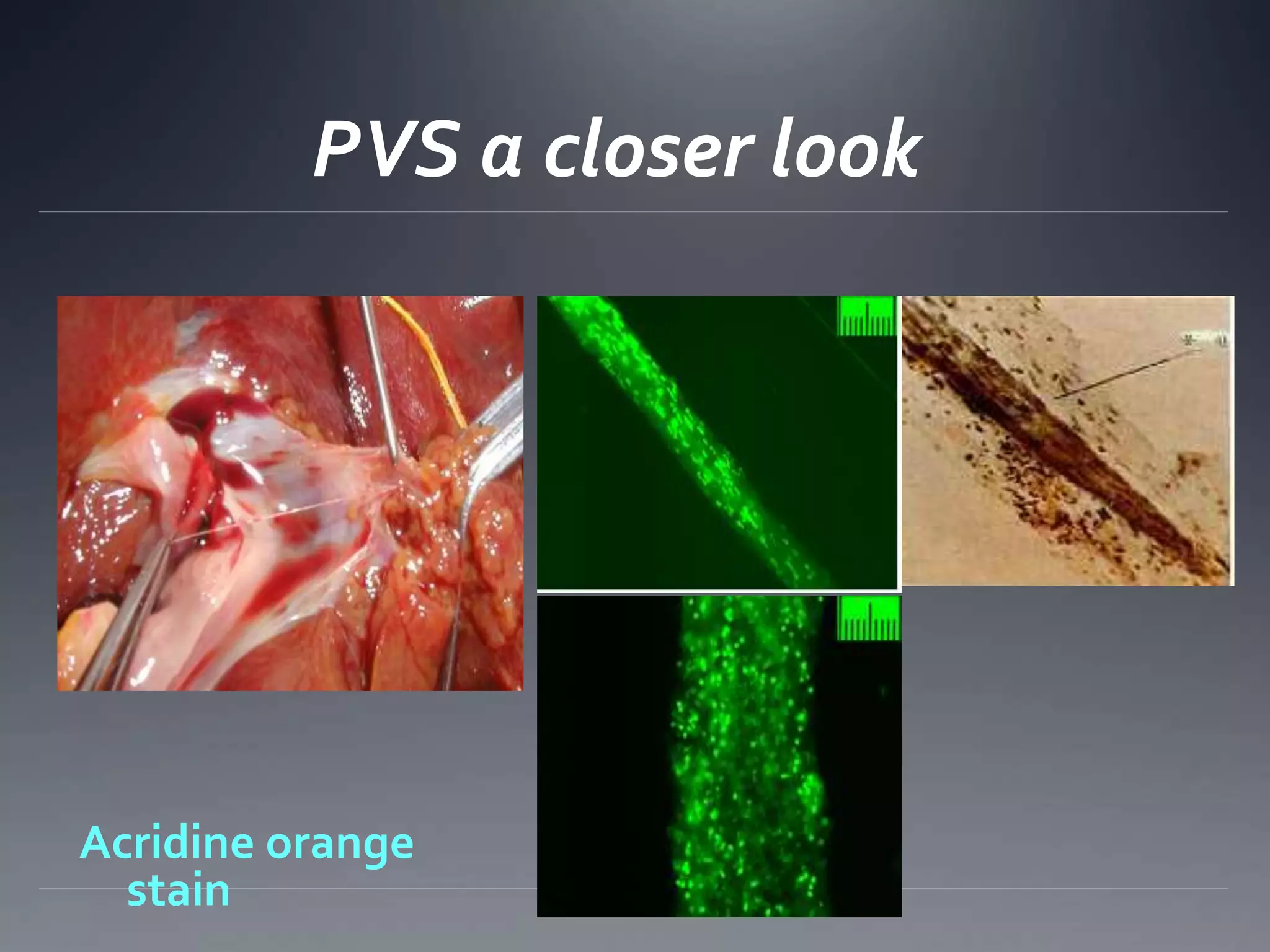 PVS a closer look
Acridine orange
stain
 