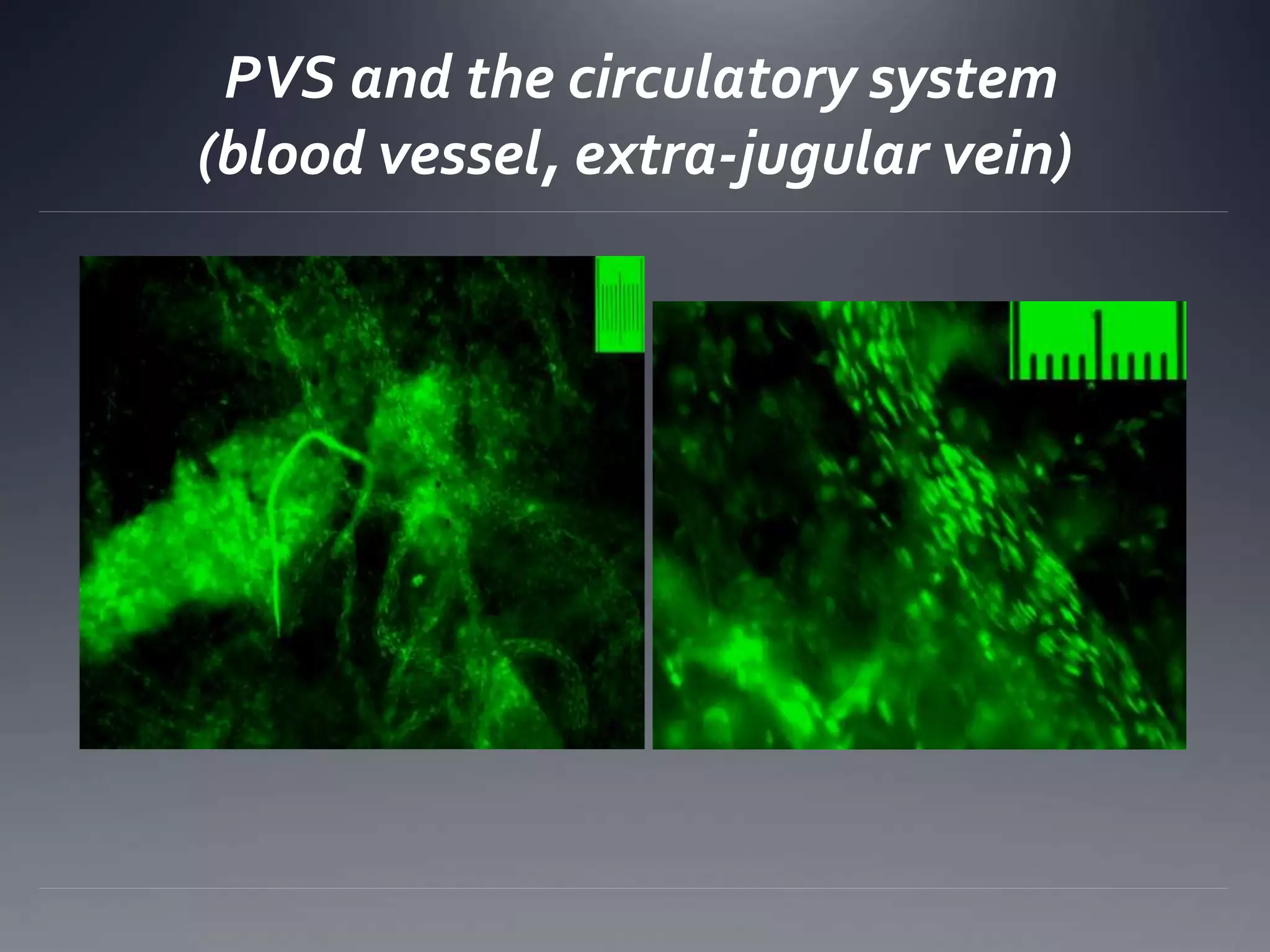 PVS and the circulatory system
(blood vessel, extra-jugular vein)
 