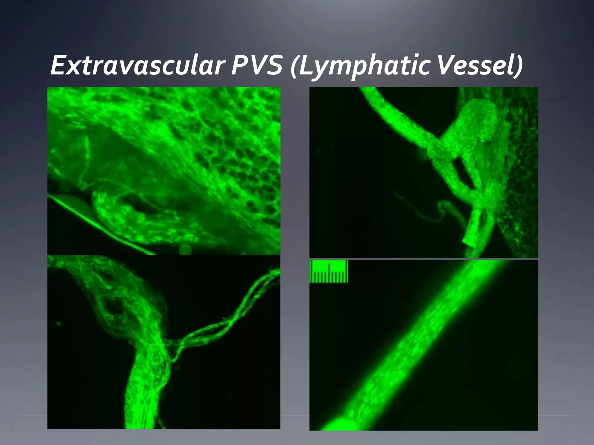 Extravascular PVS (LymphaticVessel)
 