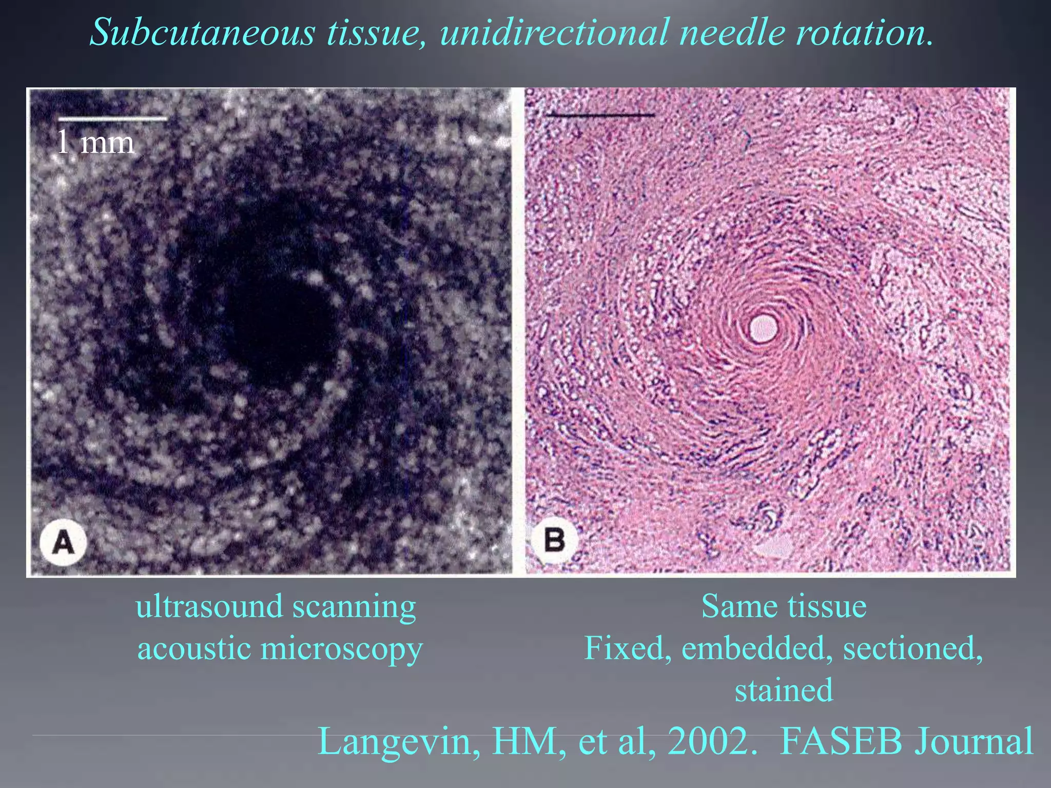 Subcutaneous tissue, unidirectional needle rotation.
ultrasound scanning
acoustic microscopy
Same tissue
Fixed, embedded, sectioned,
stained
1 mm
Langevin, HM, et al, 2002. FASEB Journal
 