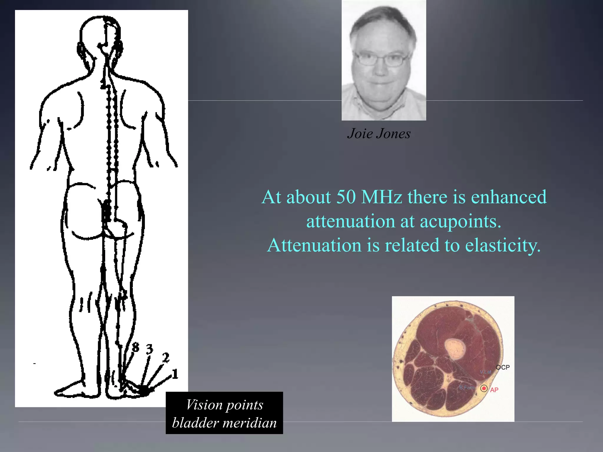Vision points
bladder meridian
Joie Jones
At about 50 MHz there is enhanced
attenuation at acupoints.
Attenuation is related to elasticity.
 