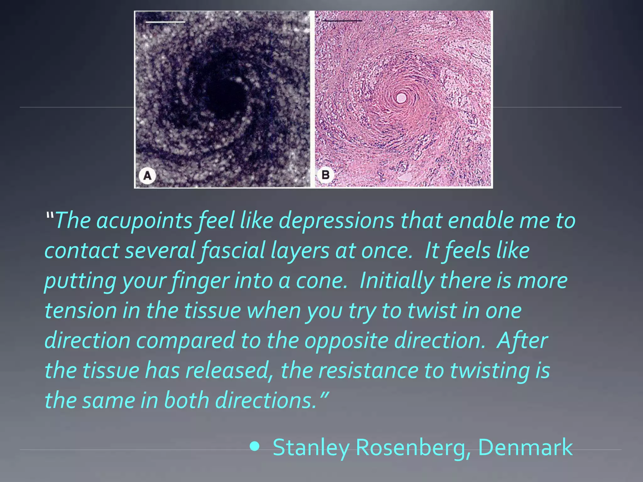 “The acupoints feel like depressions that enable me to
contact several fascial layers at once. It feels like
putting your finger into a cone. Initially there is more
tension in the tissue when you try to twist in one
direction compared to the opposite direction. After
the tissue has released, the resistance to twisting is
the same in both directions.”
 Stanley Rosenberg, Denmark
 
