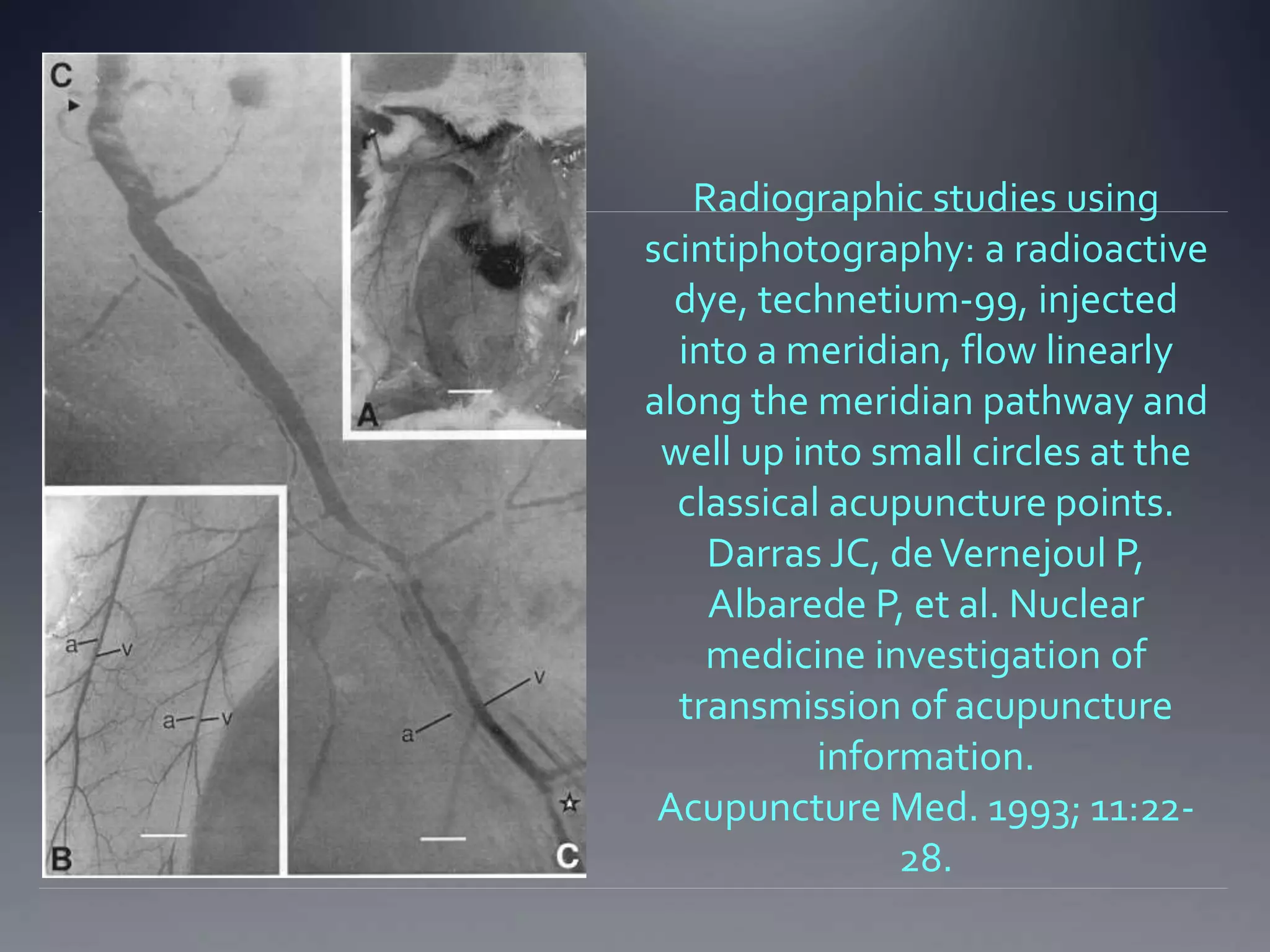 Radiographic studies using
scintiphotography: a radioactive
dye, technetium-99, injected
into a meridian, flow linearly
along the meridian pathway and
well up into small circles at the
classical acupuncture points.
Darras JC, deVernejoul P,
Albarede P, et al. Nuclear
medicine investigation of
transmission of acupuncture
information.
Acupuncture Med. 1993; 11:22-
28.
 