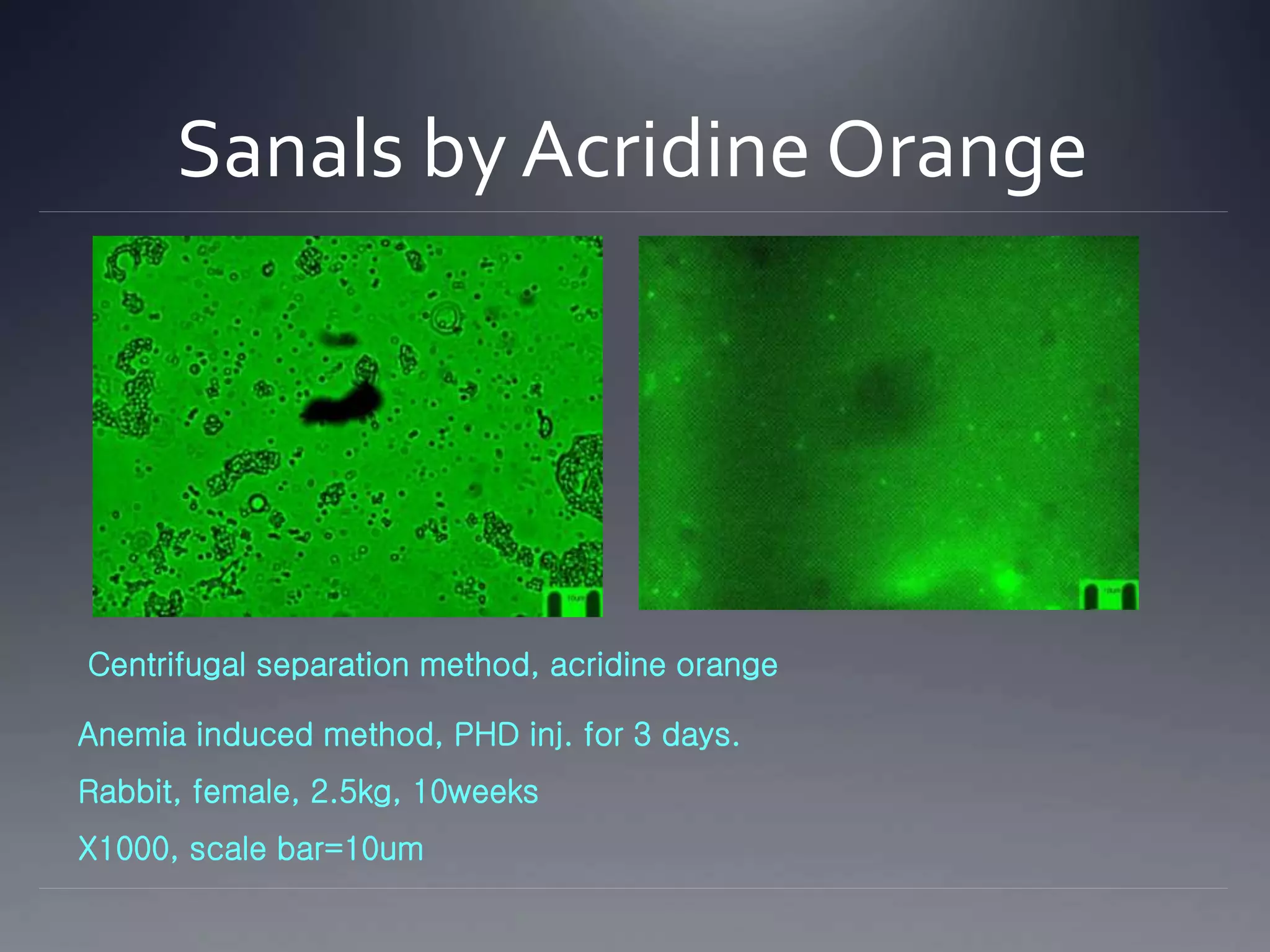 Sanals by Acridine Orange
Anemia induced method, PHD inj. for 3 days.
Rabbit, female, 2.5kg, 10weeks
X1000, scale bar=10um
Centrifugal separation method, acridine orange
 