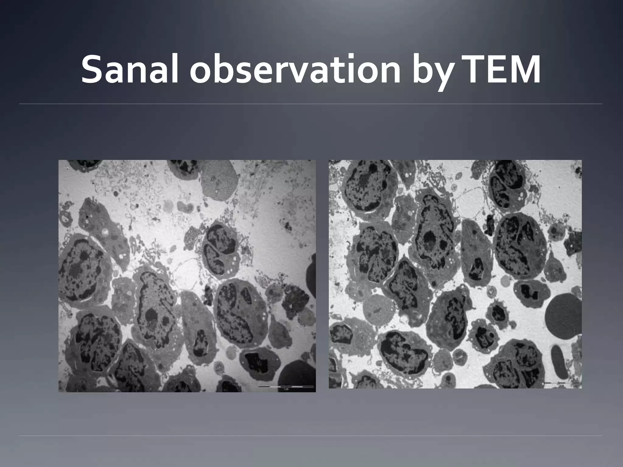 Sanal observation byTEM
 