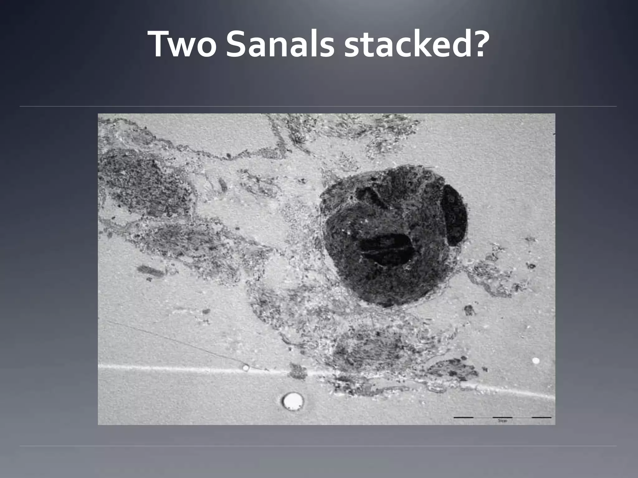 Two Sanals stacked?
 