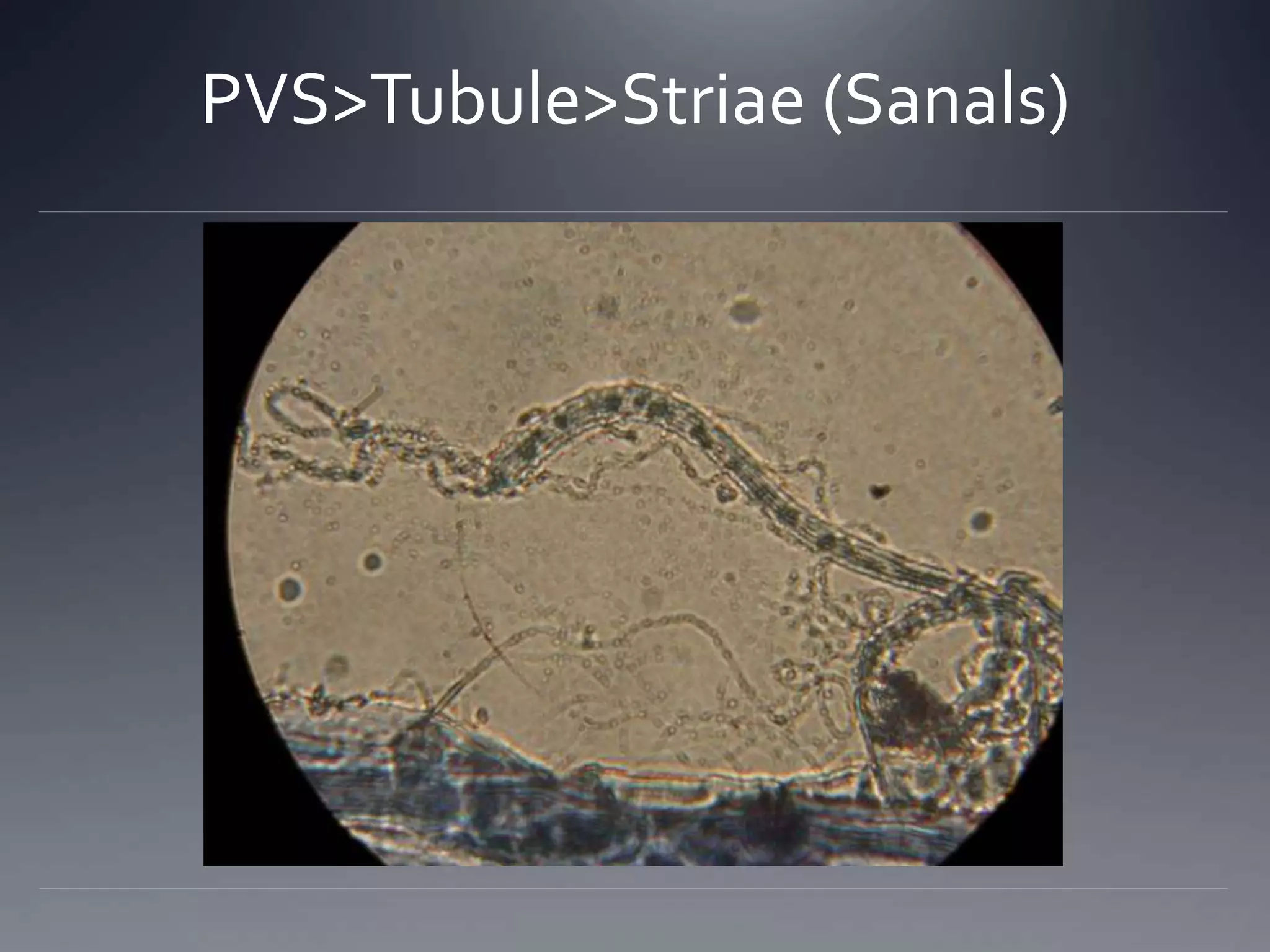 PVS>Tubule>Striae (Sanals)
 