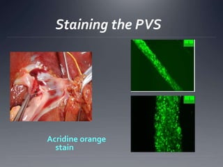 Stereomicroscopic view of PVS
-14-
Fig.1. Stereomicroscopic Images of novel threadlike structures
 