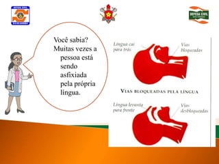 Você sabia?
   Muitas vezes a
      pessoa está
Determinar
      sendo
inconsciência
      asfixiada
      pela própria
      língua.
 