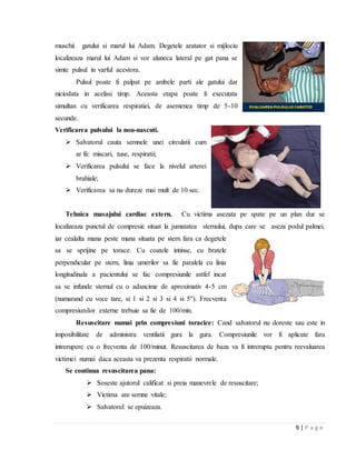9 | P a g e
muschii gatului si marul lui Adam. Degetele aratator si mijlociu
localizeaza marul lui Adam si vor aluneca lateral pe gat pana se
simte pulsul in varful acestora.
Pulsul poate fi palpat pe ambele parti ale gatului dar
niciodata in acelasi timp. Aceasta etapa poate fi executata
simultan cu verificarea respiratiei, de asemenea timp de 5-10
secunde.
Verificarea pulsului la nou-nascuti.
 Salvatorul cauta semnele unei circulatii cum
ar fii: miscari, tuse, respiratii;
 Verificarea pulsului se face la nivelul arterei
brahiale;
 Verificarea sa nu dureze mai mult de 10 sec.
Tehnica masajului cardiac extern. Cu victima asezata pe spate pe un plan dur se
localizeaza punctul de compresie situat la jumatatea sternului, dupa care se aseza podul palmei,
iar cealalta mana peste mana situata pe stern fara ca degetele
sa se sprijine pe torace. Cu coatele intinse, cu bratele
perpendicular pe stern, linia umerilor sa fie paralela cu linia
longitudinala a pacientului se fac compresiunile astfel incat
sa se infunde sternul cu o adancime de aproximativ 4-5 cm
(numarand cu voce tare, si 1 si 2 si 3 si 4 si 5''). Frecventa
compresiunilor externe trebuie sa fie de 100/min.
Resuscitare numai prin compresiuni toracice: Cand salvatorul nu doreste sau este in
imposibilitate de administra ventilatii gura la gura. Compresiunile vor fi aplicate fara
intrerupere cu o frecventa de 100/minut. Resuscitarea de baza va fi intrerupta pentru reevaluarea
victimei numai daca aceasta va prezenta respiratii normale.
Se continua resuscitarea pana:
 Soseste ajutorul calificat si preia manevrele de resuscitare;
 Victima are semne vitale;
 Salvatorul se epuizeaza.
 