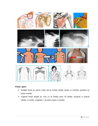 16 | P a g e
Primul ajutor:
 Sprijiniti bratul pe partea ranita intr-un bandaj tubular pentru a-i transfera greutatea pe
partea neranita.
 Asigurati bratul sprijinit pe corp cu un bandaj peste cel tubular, incepand cu punctul
median al cotului și legandu-1 pe partea opusa a corpului.
 