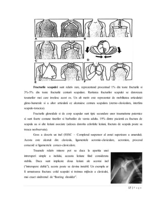 17 | P a g e
Fracturile scapulei sunt relativ rare, reprezentand procentual 1% din toate fracturile si
3%-5% din toate fracturile centurii scapulare. Raritatea fracturilor scapulei se datoreaza
tesuturilor moi care invelesc acest os. Un alt motiv este reprezentat de mobilitatea articulatiei
gleno-humerale si a altor articulatii ce alcatuiesc centura scapulara (sterno-claviculara, interfata
scapulo-toracica).
Fracturile glenoidale si de corp scapular sunt tipic secundare unor traumatisme puternice
si sunt foarte comune tinerilor si barbatilor de varsta adulta. 19% dintre pacientii cu fractura de
scapula au si alte leziuni asociate (adesea datorita celorlalte leziuni, fractura de scapula poate sa
treaca neobservata).
Goss a descris un inel (SSSC – Complexul suspensor al zonei superioare a umarului).
Acesta este alcatuit din: clavicula, ligamentele acromio-claviculare, acromion, procesul
coracoid si ligamentele coraco-claviculare.
Traumele relativ minore pot sa duca la aparitia unei
intreruperi simple a inelului, aceasta leziune fiind considerata
stabila. Daca sunt implicate doua leziuni ale acestui inel
(“intrerupere dubla”), acesta poate sa devina instabil. Un exemplu ar
fi urmatoarea fractura: colul scapulei si treimea mijlocie a claviculei,
mai exact sindromul de “floating shoulder”.
 