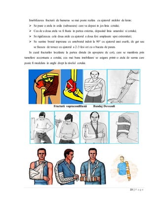 19 | P a g e
Imobilizarea fracturii de humerus se mai poate realiza cu ajutorul atelelor de lemn:
 Se pune o atela in axila (subsuoara) care va depasi in jos linia cotului;
 Cea de a doua atela va fi fixata in partea externa, depasind linia umarului si cotului;
 Se rigidizeaza cele doua atele cu ajutorul a doua fesi amplasate spre extremitati;
 Se sustine bratul impreuna cu antebratul indoit la 90° cu ajutorul unei esarfe, de gat sau
se fixeaza de torace cu ajutorul a 2-3 fesi ori cu o bucata de panza.
In cazul fracturilor localizate la partea distala (in apropiere de cot), care se manifesta prin
tumefiere accentuata a cotului, cea mai buna imobilizare se asigura printr-o atela de sarma care
poate fi modelata in unghi drept la nivelul cotului.
Fracturǎ supracondilianǎ Bandaj Dessault
 
