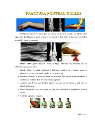 21 | P a g e
FRACTURA POUTEAU-COLLES
Imobilizarea fracturii se poate face cu oricare tip de atela speciala sau folosind atele
improvizate. Imobilizarea se poate realiza si cu ajutorul a doua atele de lemn care cuprind si
articulatiile cotului si pumnului.
Primul ajutor pentru fracturile situate ȋn lungul cubitusului sau radiusului cer ca
salvatorul sa procedeze astfel:
 Liniștiti victima și sprijiniti antebratul și incheietura mainii printr-o tracțiune ușoara și
plasarea in cea mai confortabila pozitie și cu palma in jos;
 Imobilizati antebratul și incheietura mainii pe o atela cu fașa, plasata pe partea palmara a
antebratului și intinsa de la cot pana la baza degetelor;
 Asigurati atela la brat prin bandaje inguste, unul mai sus (proximal) și altul mai jos
(distal) de fracturǎ;
 Plasati antebratul cu atelǎ peste piept, cu mana ușor mai ridicata și sprijiniji-l cu o eșarfa
de gat;
 Controlati circulația sanguina.
 