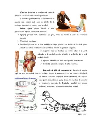 24 | P a g e
Fractura de rotula se produce prin cadere in
genunchi, se imobilizeaza in atele posterioare.
Fracturile genunchiului se imobilizeaza cu
ajutorul unei singure atele care se intinde de la
portiunea superioara a coapsei pana la calcai.
Primul ajutor pentru fracturi ȋn zona
genunchiului implica urmatoarele manevre:
 Sprijiniți piciorul ranit, realiniindu-l cu grija, numai in masura in care nu accentuati
durerea.
 Nu utilizați tractiunea.
 Imobilizati piciorul pe o atela suficient de lunga pentru a se intinde de la bazin pana
dincolo de calcai, cu infǎșare sub scobiturile naturale la genunchi și glezna.
 Asigurati atela cu bandaje de forma cifrei 8 in jurul
șoldurilor și la capǎtul superior al atelei și un bandaj lat in jurul
gambei și atelei.
 Sprijiniti membrul cu atela ȋntr-o pozitie ușor ridicata.
 Controlați circulatia sangelui la laba piciorului.
Fracturile de tibie si/ sau peroneu - fracturile de gamba
implicand unul sau ambele oase se intalnesc frecvent in sport dar ele se pot produce si la locul
de munca. Fracturile capetelor distale (inferioare) ale acestor
oase pot fi confundate cu glezna luxata. In plus fata de semnele
si simptomele generale, la fracturile gambei pot aparea
deformari accentuate, strambarea sau rotirea gambei.
 