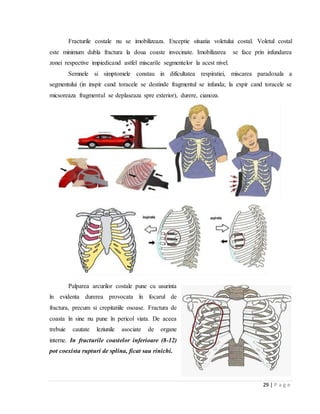 29 | P a g e
Fracturile costale nu se imobilizeaza. Exceptie situatia voletului costal. Voletul costal
este minimum dubla fractura la doua coaste invecinate. Imobilizarea se face prin infundarea
zonei respective impiedicand astfel miscarile segmentelor la acest nivel.
Semnele si simptomele constau in dificultatea respiratiei, miscarea paradoxala a
segmentului (in inspir cand toracele se destinde fragmentul se infunda; la expir cand toracele se
micsoreaza fragmentul se deplaseaza spre exterior), durere, cianoza.
Palparea arcurilor costale pune cu usurinta
în evidenta durerea provocata în focarul de
fractura, precum si crepitatiile osoase. Fractura de
coasta în sine nu pune în pericol viata. De aceea
trebuie cautate leziunile asociate de organe
interne. In fracturile coastelor inferioare (8-12)
pot coexista rupturi de splina, ficat sau rinichi.
 