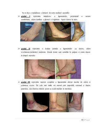 41 | P a g e
Se va face o stadializare a leziunii de catre medicul specialist:
 gradul I reprezinta intinderea a ligamentelor, prezentand o usoara
sensibilitate, edem (umflare a gleznei) si rigiditate. Apare durere la mers.
 gradul II reprezinta o leziune partiala a ligamentelor cu durere, edem
si echimoza (invinetire) moderate. Zonele lezate sunt sensibile la palpare si exista durere
in timpul mersului.
 gradul III reprezinta ruperea completa a ligamentului afectat insotita de edem si
echimoza severe. De cele mai multe ori mersul este imposibil, existand o durere
puternica, desi durerea initiala poate sa scada imediat in intesitate.
 