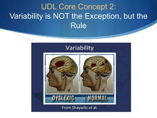 UDL Core Concept 2: 
Variability is NOT the Exception, but the 
Rule 
 