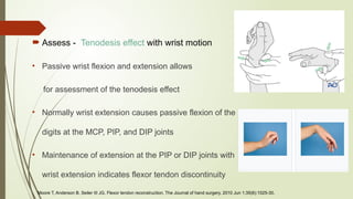 Comprehensive Overview of Flexor and Extensor Tendon Injuries of the ...