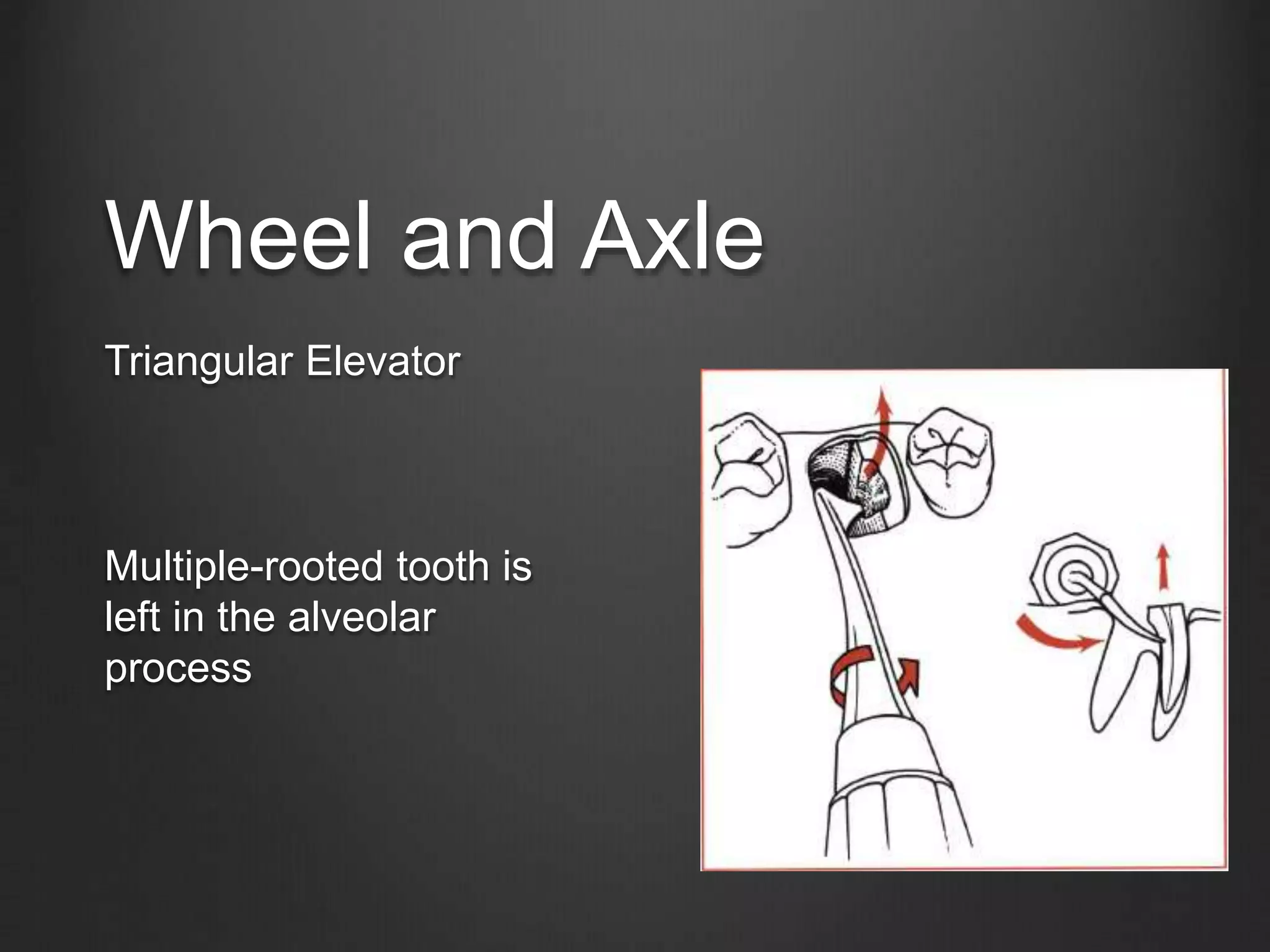 Wheel and Axle
Triangular Elevator
Multiple-rooted tooth is
left in the alveolar
process
 