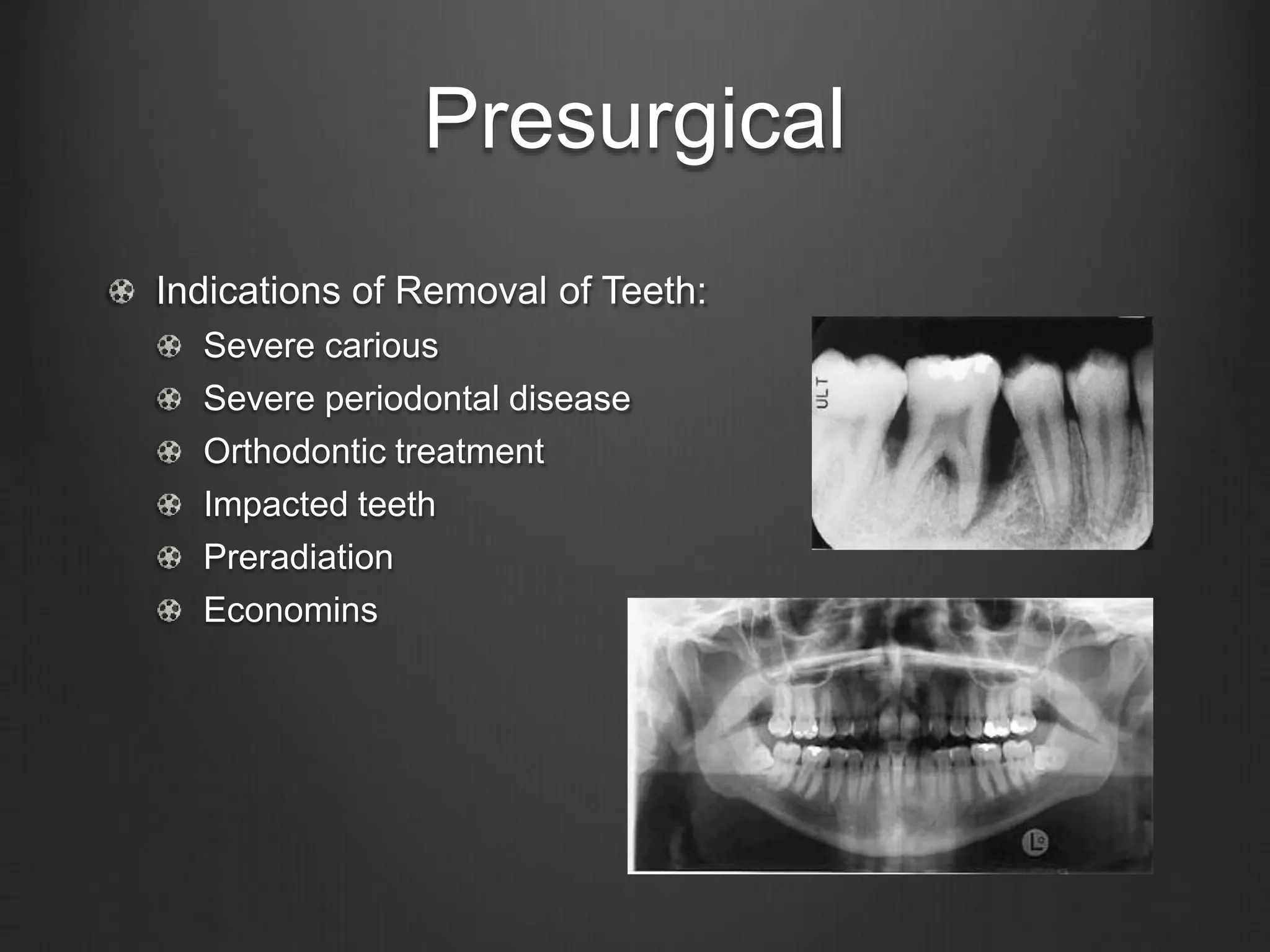 Presurgical
Indications of Removal of Teeth:
Severe carious
Severe periodontal disease
Orthodontic treatment
Impacted teeth
Preradiation
Economins
 