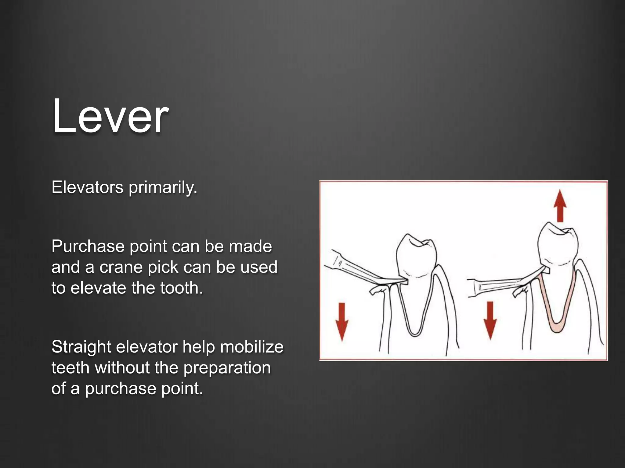 Lever
Elevators primarily.
Purchase point can be made
and a crane pick can be used
to elevate the tooth.
Straight elevator help mobilize
teeth without the preparation
of a purchase point.
 
