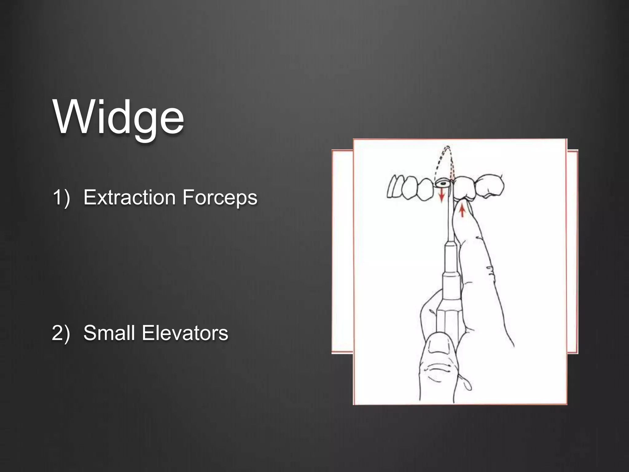 Widge
1) Extraction Forceps
2) Small Elevators
 