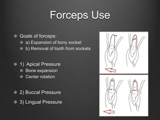 Princinples of Tooth Extraction | PPTX