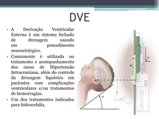 DVE
• A Derivação Ventricular
Externa é um sistema fechado
de drenagem usando
em procedimento
neurocirúrgico.
• Comumente é utilizada no
tratamento e acompanhamento
dos casos de Hipertensão
Intracraniana, além do controle
da drenagem liquórica em
pacientes com complicações
ventriculares e/ou tratamentos
de hemorragias.
• Um dos tratamentos indicados
para hidrocefalia.
 