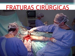 FRATURAS CIRÚRGICAS
 