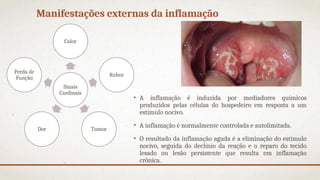 Manifestações externas da inflamação
• A inflamação é induzida por mediadores químicos
produzidos pelas células do hospedeiro em resposta a um
estímulo nocivo.
• A inflamação é normalmente controlada e autolimitada.
• O resultado da inflamação aguda é a eliminação do estímulo
nocivo, seguida do declínio da reação e o reparo do tecido
lesado ou lesão persistente que resulta em inflamação
crônica.
Sinais
Cardinais
Calor
Rubor
Tumor
Dor
Perda de
Função
 