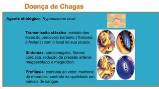 Agente etiológico: Trypanosoma cruzi
Sintomas: cardiomegalia, fibrose
cardíaca, redução da pressão arterial,
megaesôfago e megacólon.
Profilaxia: combate ao vetor, melhoria
de moradias, controle de qualidade em
bancos de sangue.
Transmissão clássica: contato das
fezes do percevejo barbeiro (Triatoma
infestans) com o local de sua picada.
 
